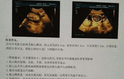 学会看b超单数据, 轻松分辨胎儿性别, 以后再也不用求医生了!