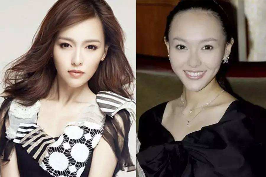 不止男明星有谢顶危机,娱乐圈多名女明星出现发际线后移现象