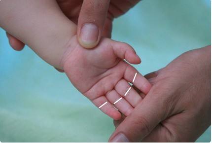 医生说应该是疳积,这种病是小孩经常得的,这种病情的原因大概都是因为