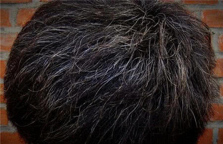 白头发的"天然克星",洗头水里放一点,白发悄悄变回黑!