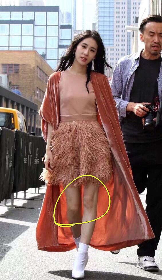 继吉克隽逸的三角裤被吐槽之后,满腿都是疙瘩的张碧晨也没幸免!
