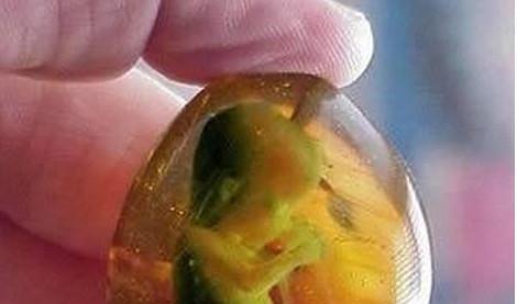 听信婆婆的话使40周胎儿胎死腹中, 手术后婆婆说的让她伤心欲绝