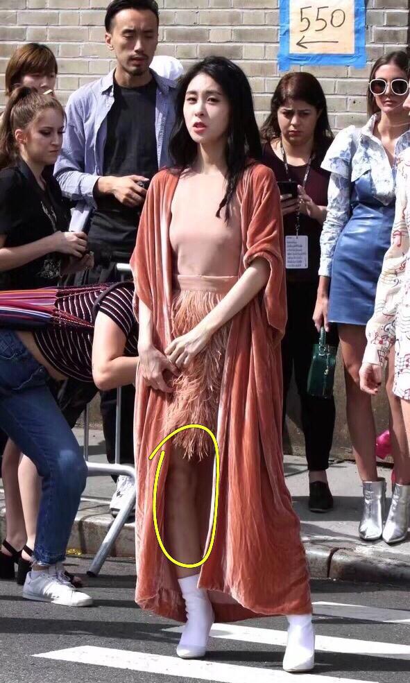 继吉克隽逸的三角裤被吐槽之后,满腿都是疙瘩的张碧晨也没幸免!