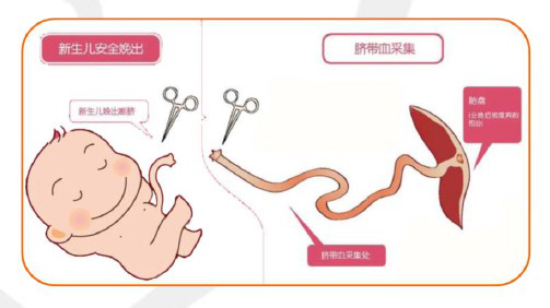 吉源干细胞医学研究院:如何储存脐带血?