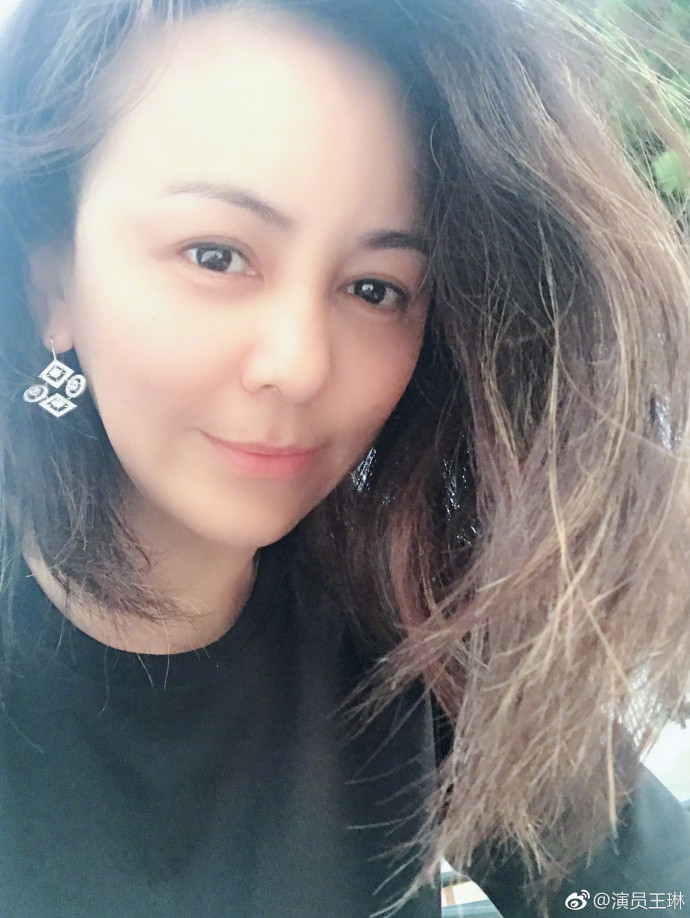 48岁雪姨王琳重病进院双眼无神超憔悴鱼尾纹明显还有白发