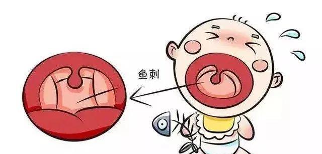 鱼刺卡喉咙的处理方法,很管用的方法,留着