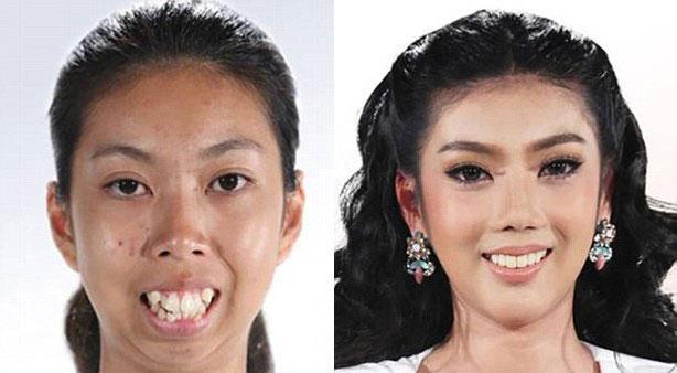 好多丑都是因为它!|牙齿|五官|美女_新浪新闻