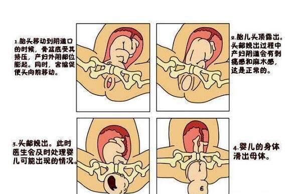 生孩子只是一点痛