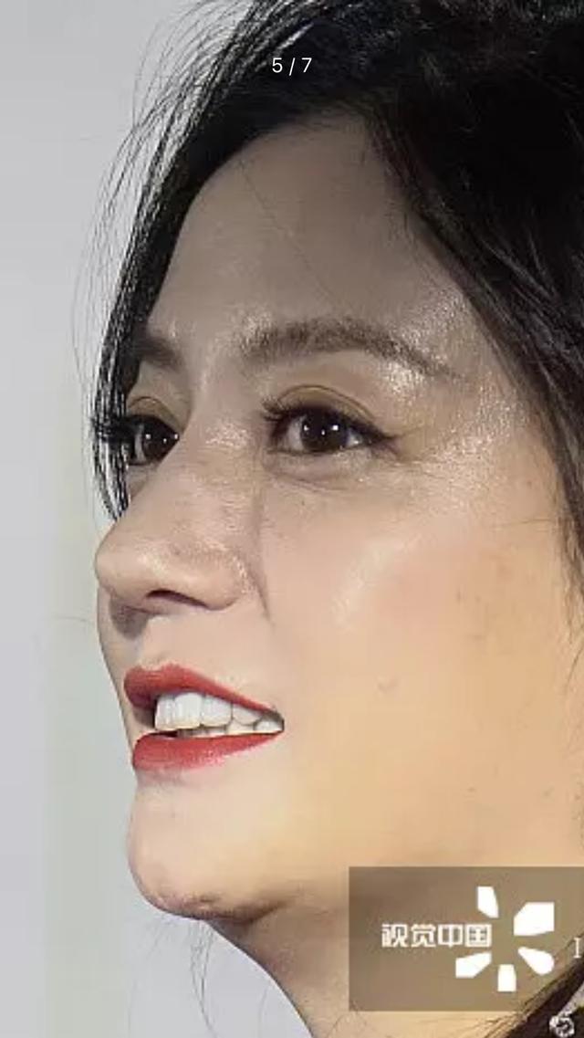 赵薇未修图曝光,脸上斑连粉底都遮不住,下巴的坑遭网友质疑整容