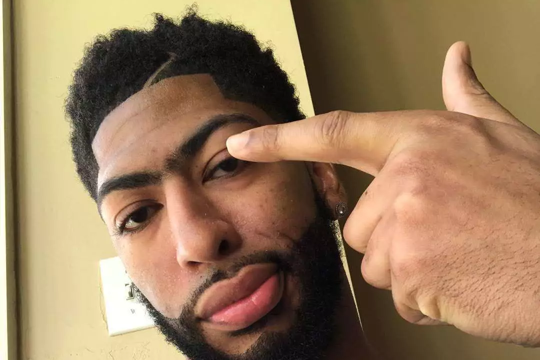 麦考伤病情况已公布!浓眉哥昨天剃眉毛,仅一天时间又长出来了?