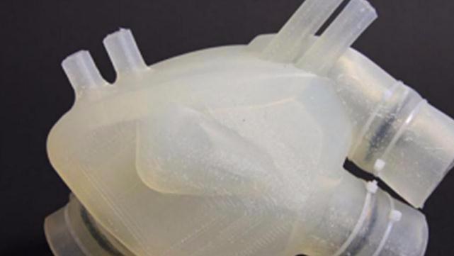 医学3D动画演示:心脏冠脉支架放置过程