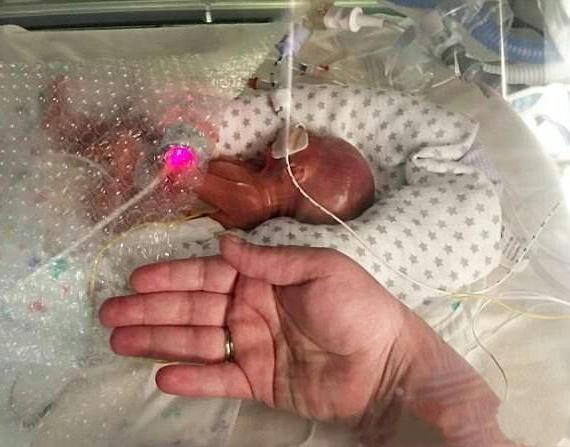 孩子的母亲怀孕7月的时候已经决定要打掉这个孩子,但是在堕胎时孩子