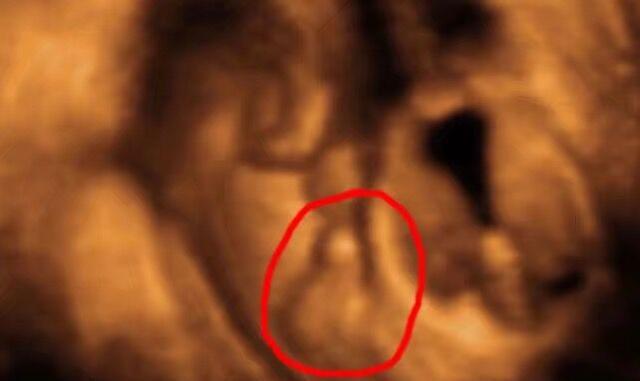 四维排畸宝宝长"小尾巴",孕妈当场哭昏,丈夫却意味深长的笑了