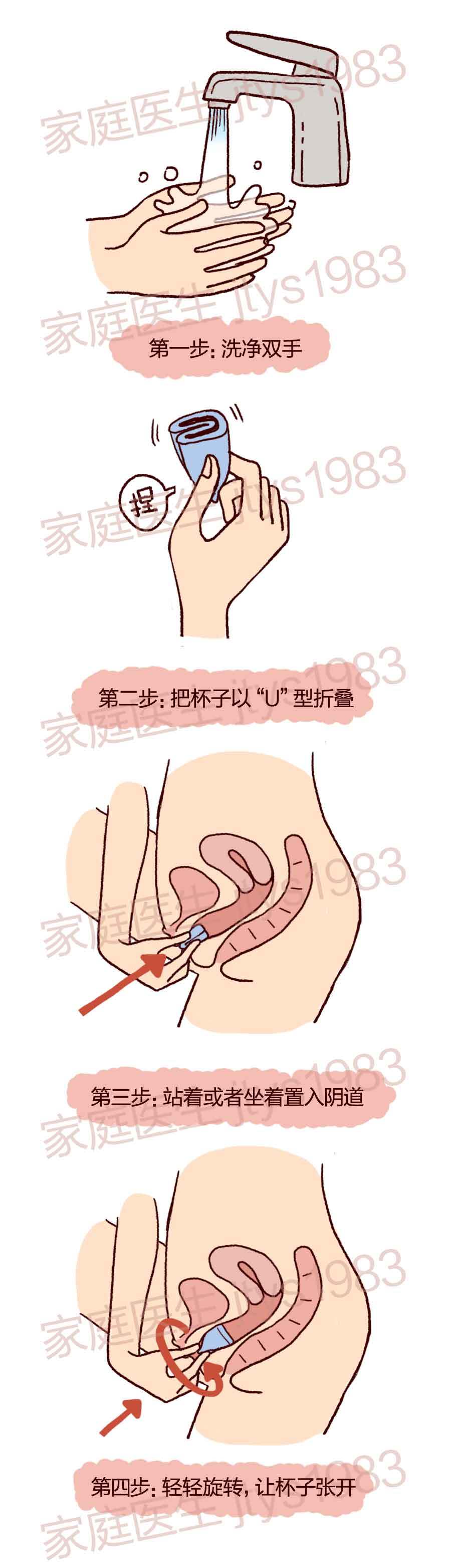 "月经杯"神器现世 从此告别姨妈巾?