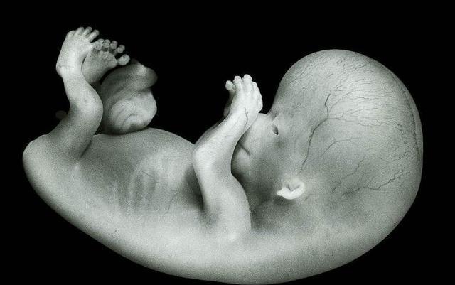 胎儿畸形有个"高峰期",躲开这"3件事",孕妈轻松熬过去!