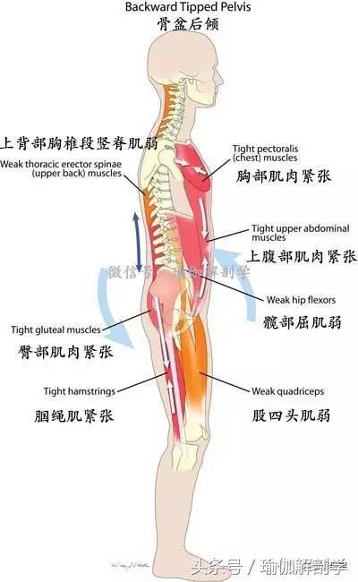 垂屁股(臀下垂),肌肉的状态表现为腹肌,髂腰肌,腰背部肌肉弱,大腿后侧