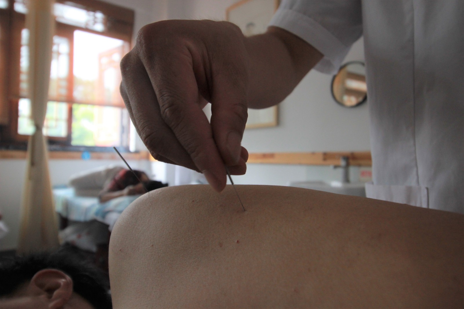 80后"老中医"擅长中医针灸推拿 日接诊上百人