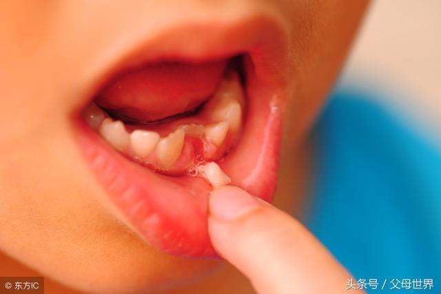 宝宝换牙期这3种情况妈妈必须知道附换牙顺序图