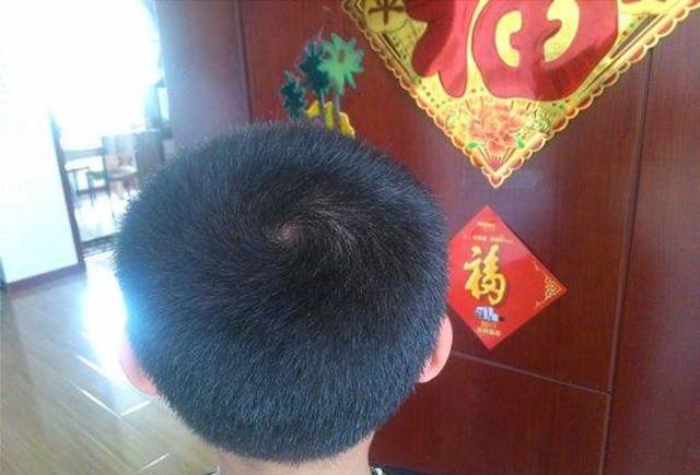 宝宝头上的旋涡, 没想到跟智力还有关系!