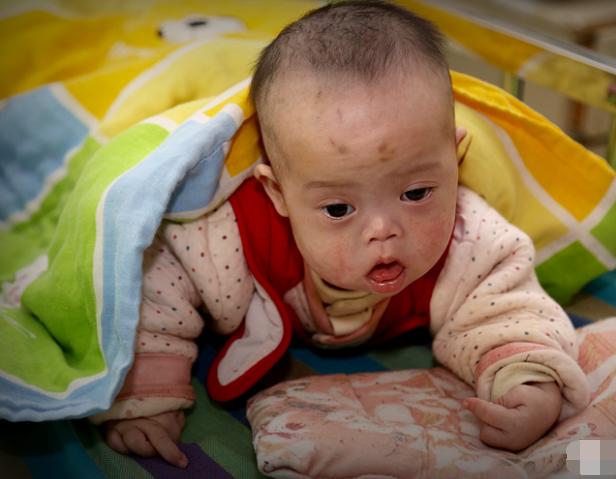 王女士哭着说,小思原本是个聪明活泼的孩子,会解手机密码,会用遥控器