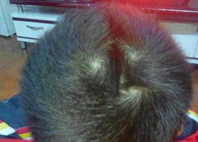 影响孩子头旋其实原因很简单,头旋多的孩子不一定熊