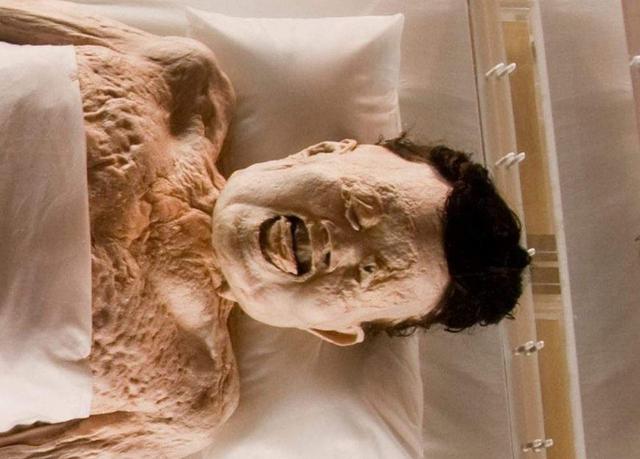 2000多年前古尸偶然出现打针时血管纹路仍鼓出皮肤柔软有弹性