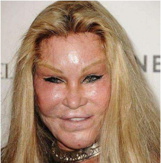 我还能做点什么来挽救你,我的整容脸?