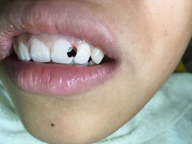 为什么要这样对他他才13岁