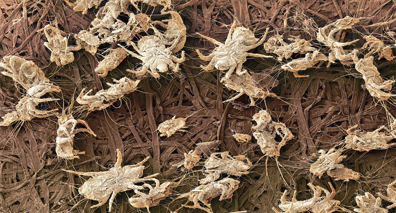 家里床单上螨虫成千上万,只需用它泡一泡,让螨虫"有来无回"