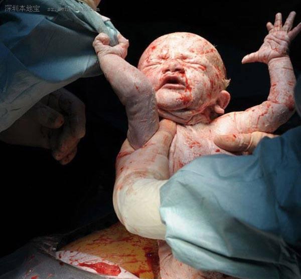 你所不知道的, 在分娩中不止孕妇撕心裂肺的痛, 胎宝宝也很痛苦