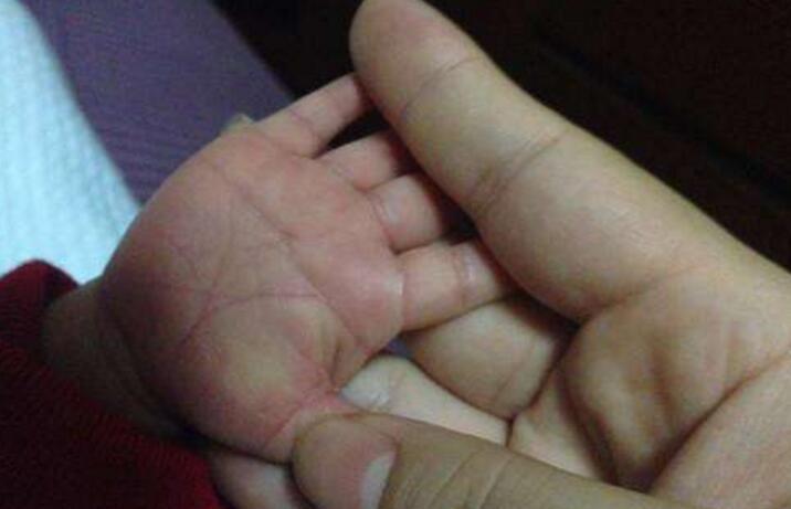 身体都很健康,但是我婆婆突然发现宝宝的手上有那个断掌纹,两个手上都