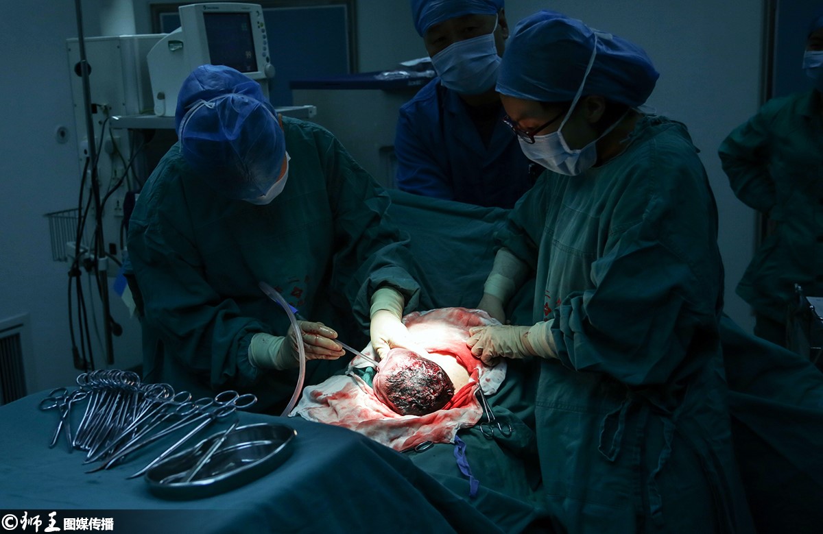 摄影师实拍39岁高龄产妇剖腹产全过程 感叹母爱伟大