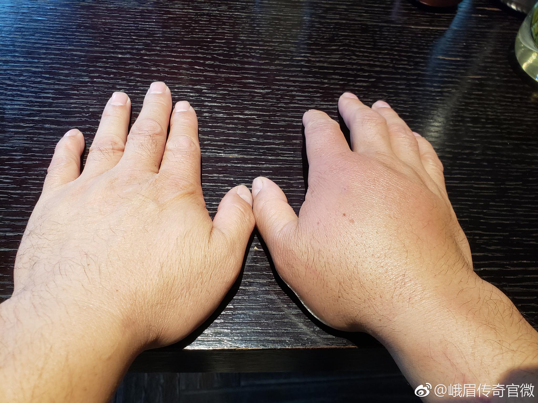 王知亮和雷雷的比赛,雷雷挨了127个大摆拳,不得不说