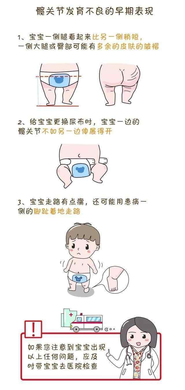 宝宝走路一歪一些?做个髋关节检查,妈妈才放心!