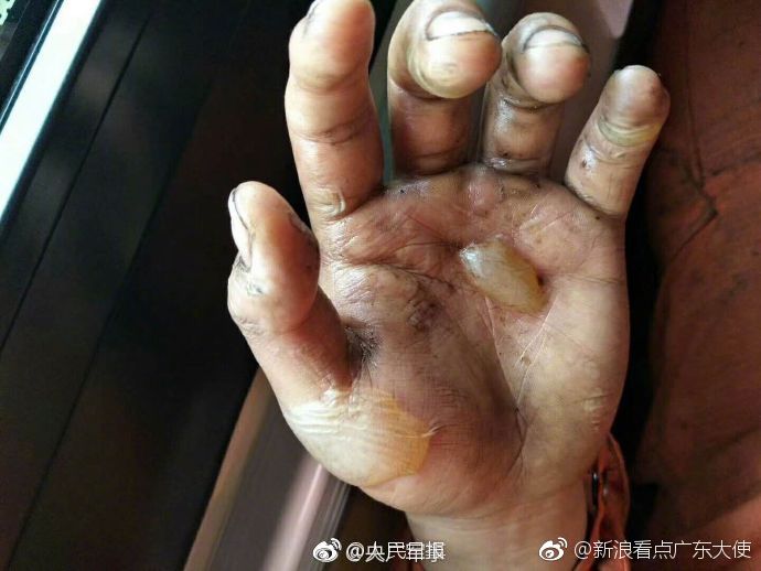 你好,明天 一张95后森警战士满手伤痕的照片刷屏