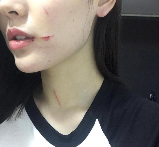全民主播女友被殴打,伤痕累累,网友感慨:主播也心酸