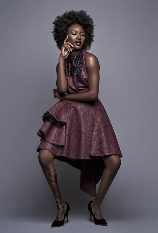 海地女孩因"腿丑"备受嘲讽 后成模特勇敢追梦