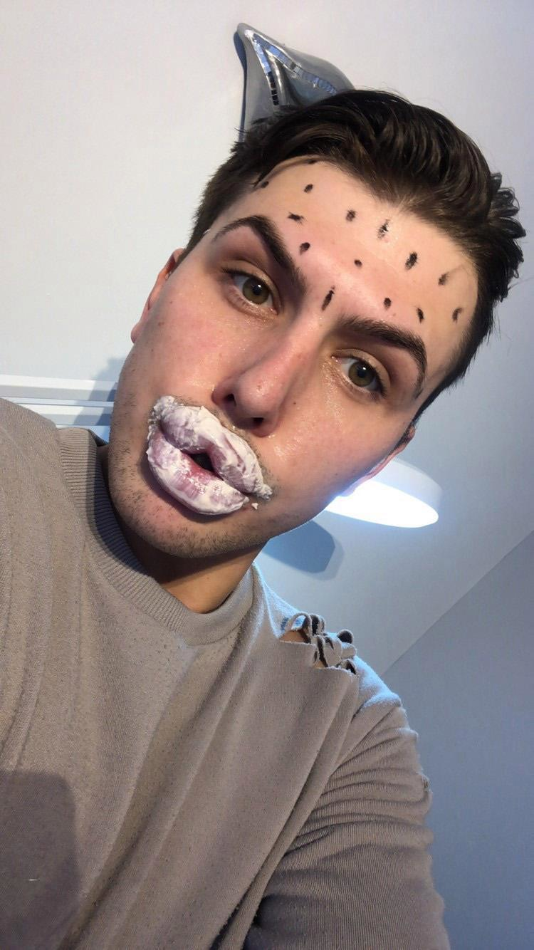 凯莉詹娜以香肠唇闻名男粉丝为了模仿金小妹整成这个样子