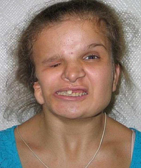 外国女孩被亲妈嫌丑, 要回家必须整容