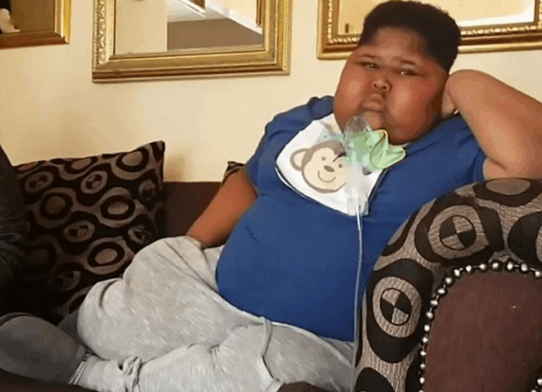 10岁男孩重达180斤,无法停止进食,不给食物就吃厕纸和土!