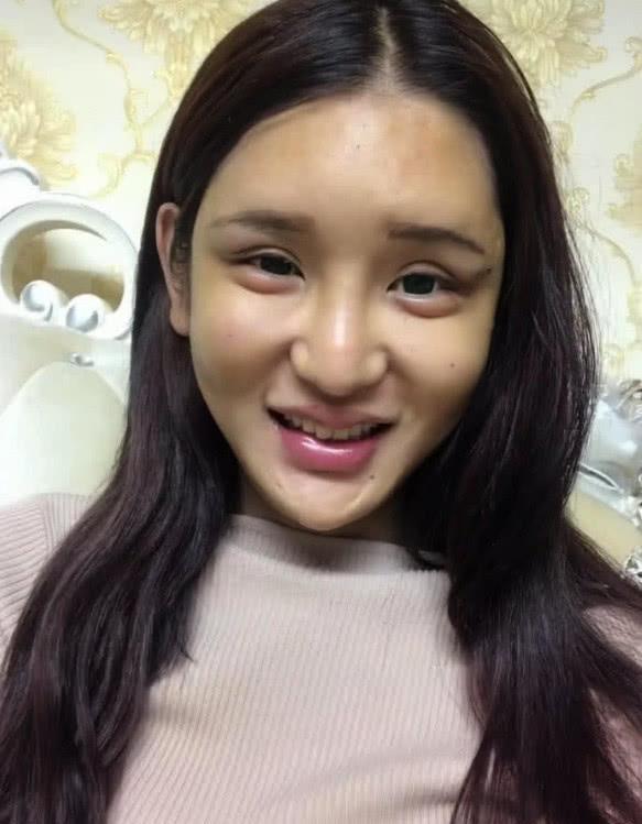 网红承认整容,关掉美颜滤镜后,网友:这种美我欣赏不来
