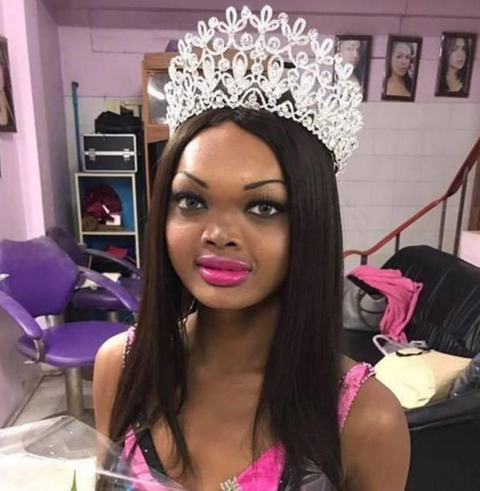 泰国丑女因丑的有特色,参加选美被国际大牌相中,后成为一线超模