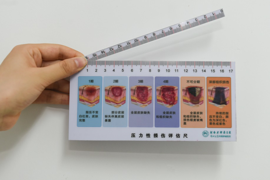 医院护理员发明了一款"多功能压力性损伤评估尺"秒测压疮功能全