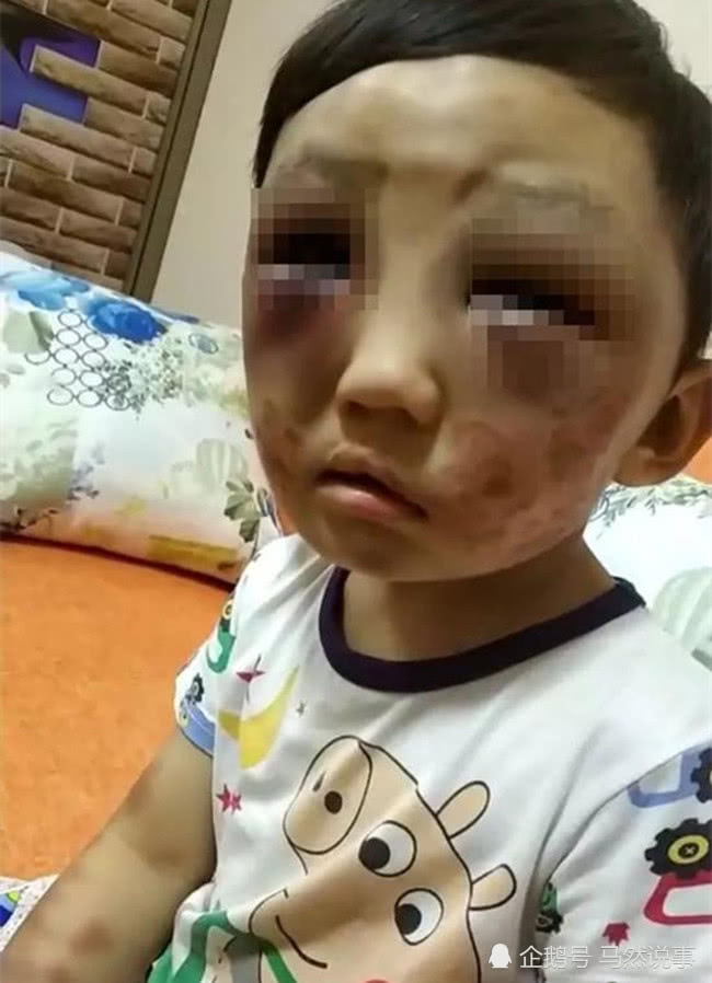 离婚女子经常毒打4岁儿子,邻居看了心疼,妈妈:打孩子天经地义