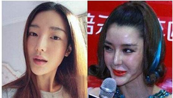 我还能做点什么来挽救你，我的整容脸？|整容|为了谁|战鼓_新浪新闻
