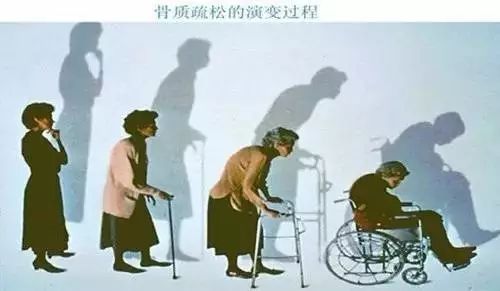 人体衰老时间表中老年人必看