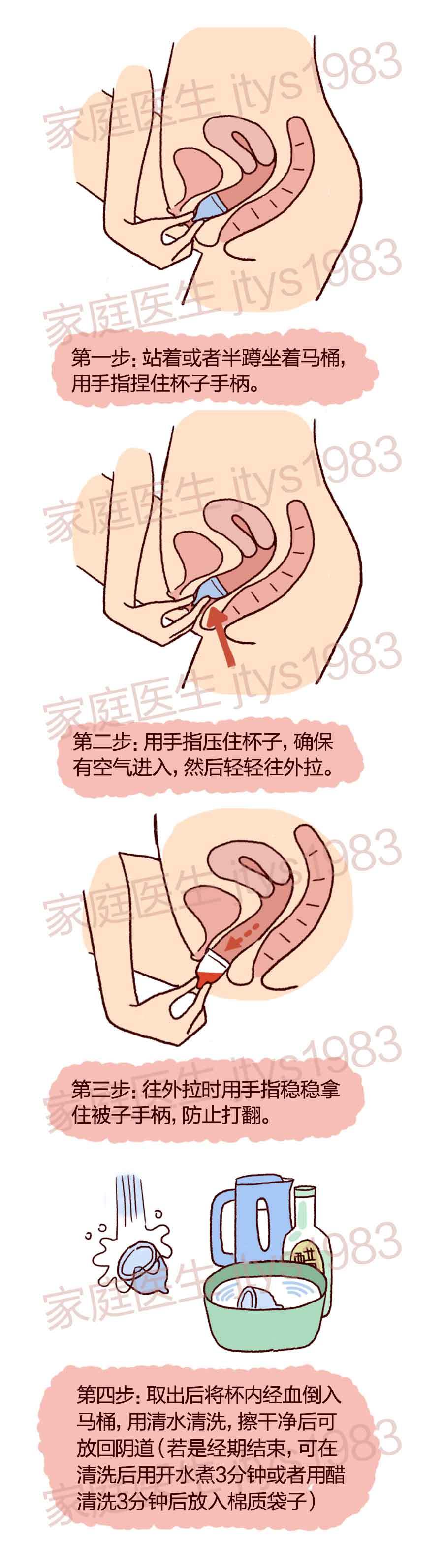 "月经杯"神器现世 从此告别姨妈巾?