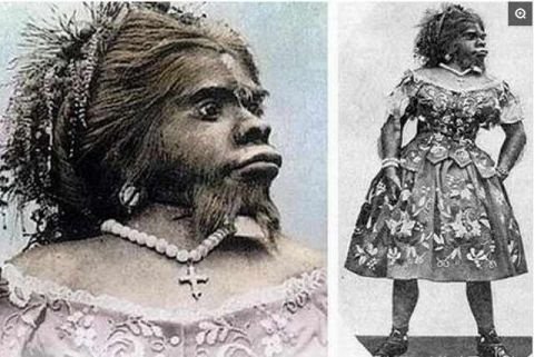 照片为美国的一名女毛孩,据闻是世界上毛发最长的女孩,体毛竟然长到都