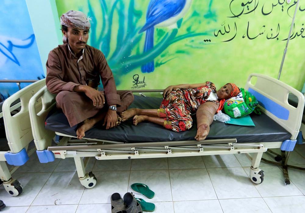 也门战乱每年约1万人患有癌症,看完这组照片让人心痛!