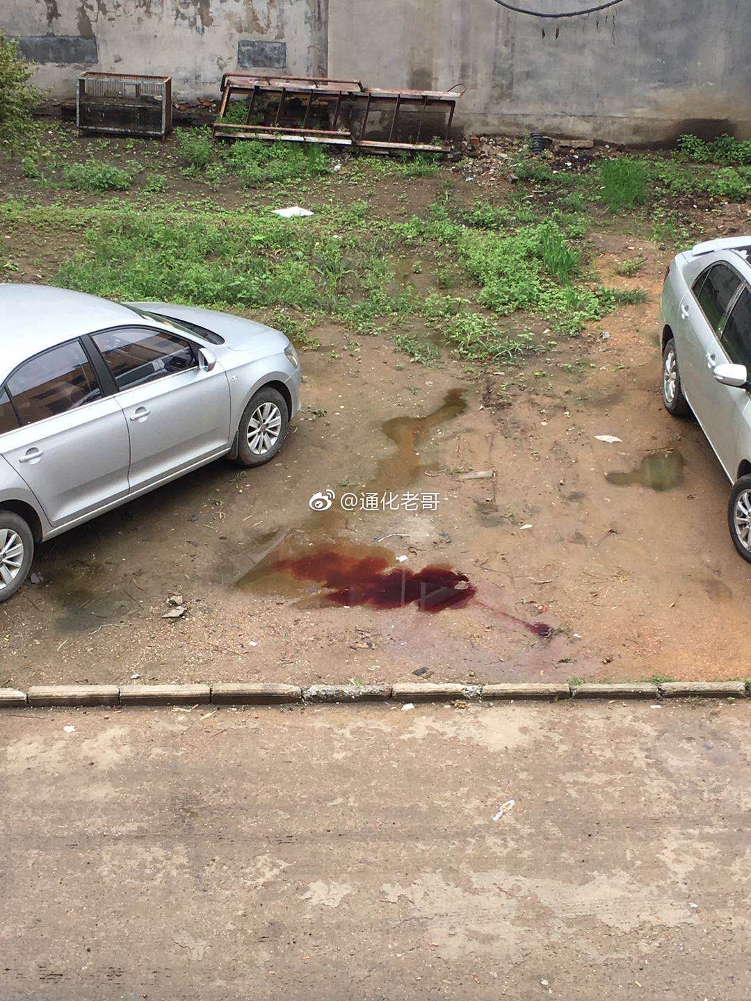 通化身边事 【患者突发病情 中心医院志愿者真情服务】2018年4月11日.